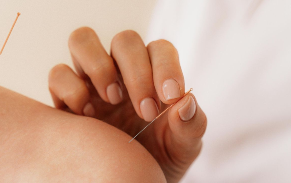 Acupuntura en China